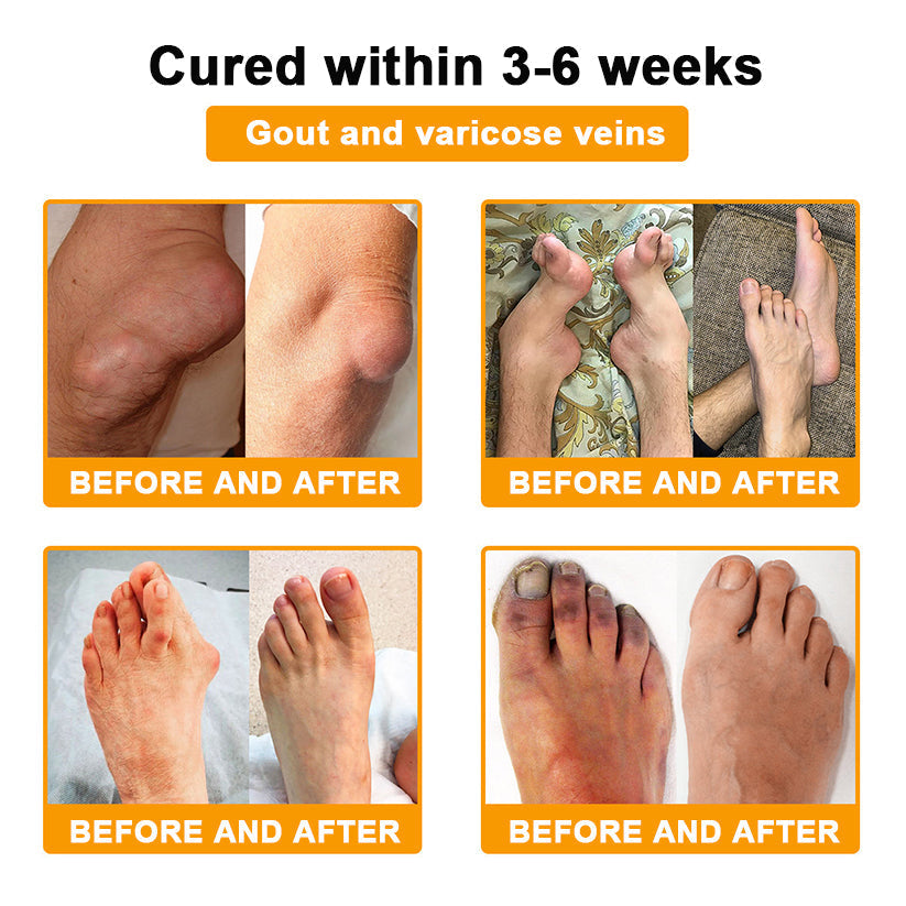AAOS Official: Daasry™ Botulinum Toxin & Bee Venom Pain-Relief Bone Healing Cream