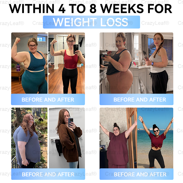 ✨👑CA Clinically Proven|Official Store |Buildleaf® Tirzepatide Slimming & Health Nano Microneedle Patch with Collagen & Matrixyl 3000丨Targets Obesity, Loose Skin, High Blood Pressure, Diabetes, Fatty Liver, Joint Pain, Brain Fog, Low Energy and More